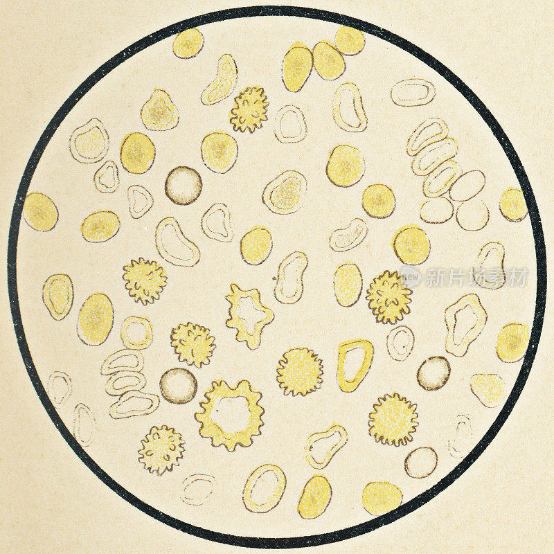 人类红细胞的显微镜观察- 19世纪